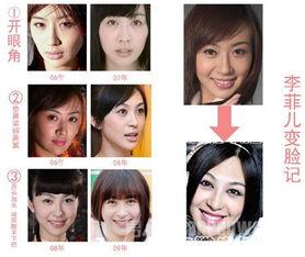 西安整容爆料事件视频最新,揭秘行业乱象,患者权益引关注 第1张 西安整容爆料事件视频最新,揭秘行业乱象,患者权益引关注 第1张